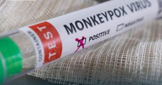 Border Health Services issue advisory on Monkeypox
