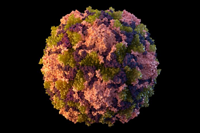 Poliovirus detected in Karachi’s Sewage Sample