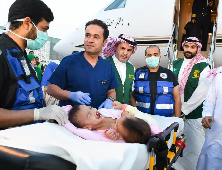 Filipino Siamese twins arrive in Riyadh for evaluation towards separation surgery