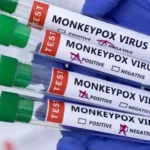 Medical board constituted for monkeypox patient at LGH