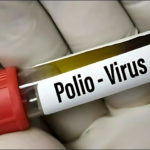 Polio surveillance shows sharp decline in positive samples