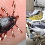 First death from Congo fever reported in Sindh