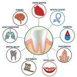 Dental hygiene crucial for overall health: Dentists