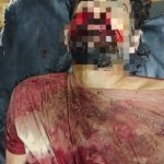 ICT Police raiding team ambushed in Noon; one accused killed, another injured
