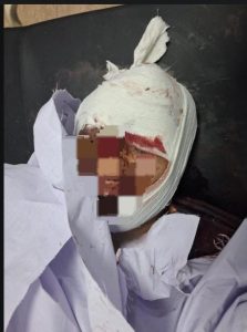 SP Adeel Akbar passes away after self-inflicted shooting