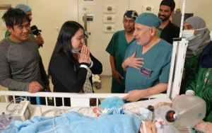 72nd conjoined twins operation marks new Saudi medical milestone