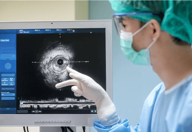 Precision Cardiolog-New era