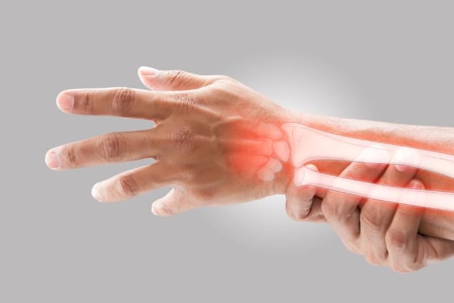 Health experts stress osteoporosis prevention